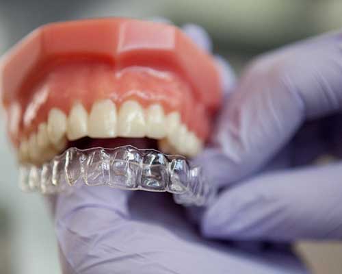 Dişler Arası Bölgede Aşındırma