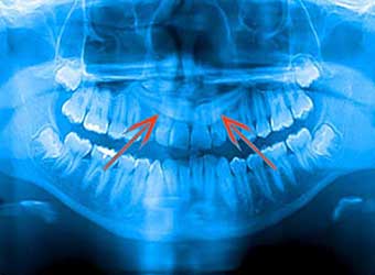Ortodontist Dr Hatice Saracoglu Canakkale Gomulu Kaninler